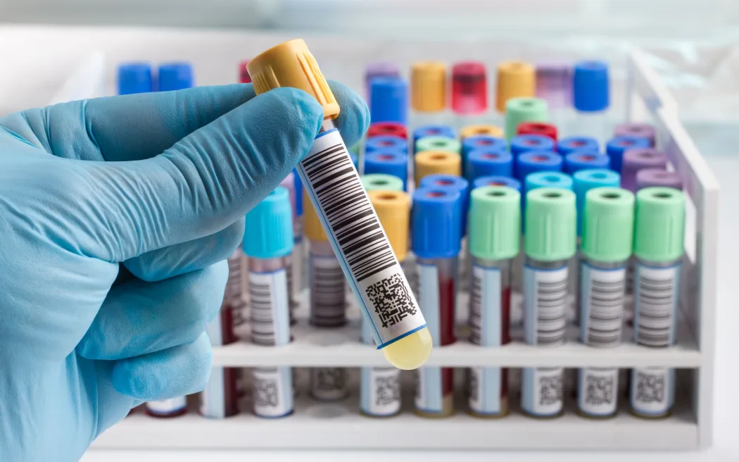 A lab technician holding blood tube test.