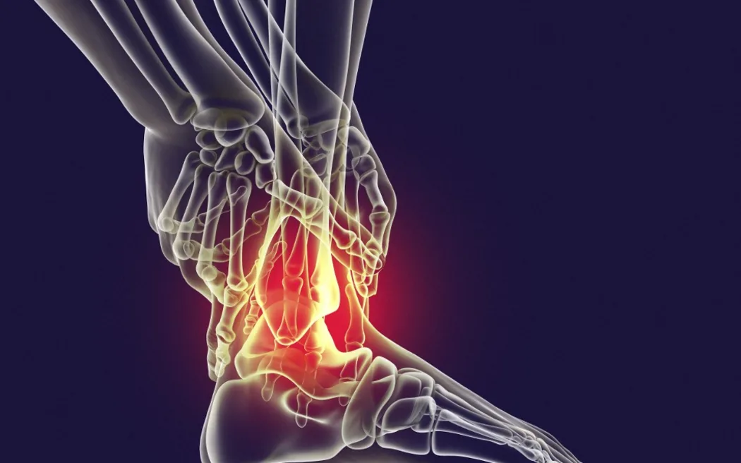 Man with foot pain and highlighted skeleton, computer illustration. (Photo by KATERYNA KON/SCIENCE PHOTO LIBRA / KKO / Science Photo Library via AFP)