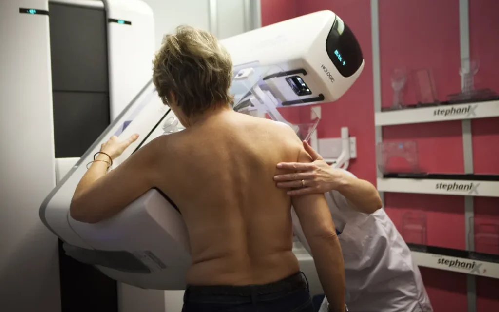New Zealand mở rộng tầm soát ung thư vú miễn phí, hàng chục nghìn phụ nữ hưởng lợi 1 Breast cancer screening