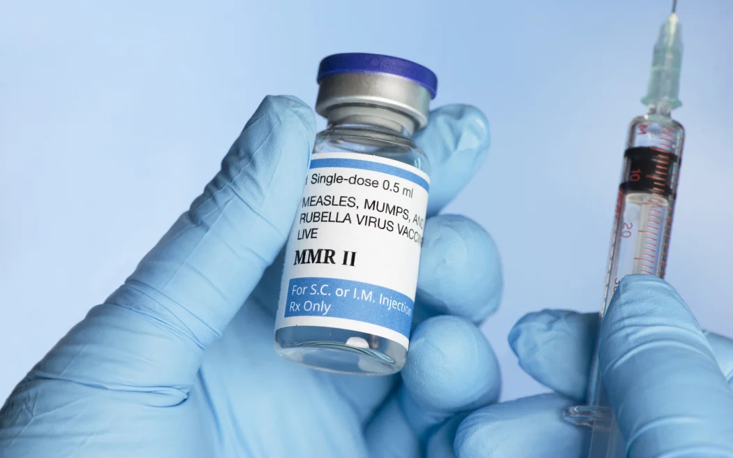 Sởi bùng phát ở New Zealand: Cảnh báo về virus chết người đang lây lan và những điều cần biết 3 Nurse holding MMR (measles, mumps and rubella) vaccine vial in gloved hand with syringe. (Photo by SHERRY YATES YOUNG/SCIENCE PHOTO / SYO / Science Photo Library via AFP)