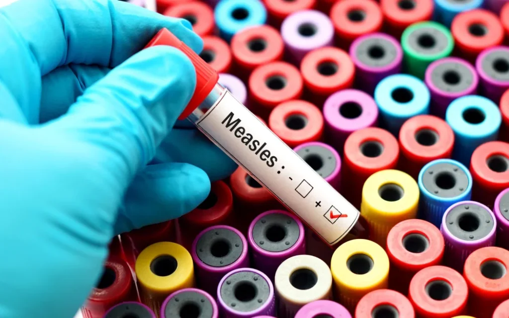 Dịch sởi bùng phát: Y tá nông thôn nỗ lực xóa bỏ tâm lý 'ngại tiêm' vắc xin 1 no caption.